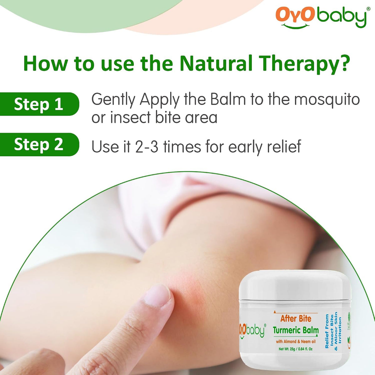 OYO BABY After Bite Turmeric Balm with Almond & Neem Oil for Babies – Relief from Rashes, Mosquito & Insect Bites, 100% Ayurvedic, 25g