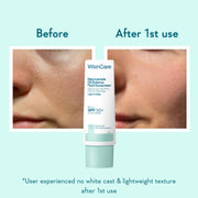 WishCare Niacinamide Oil Balance Fluid Sunscreen SPF 50 PA++++ In-Vivo Tested | 8Hrs+ SPF Protection | Lightweight, Matte & No White Cast | Photostable Sunscreen SPF50 For Oily Skin, Sensitive, Dry & Combination Skin | For Women & Men | 50 ml
