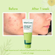 WishCare Salicylic Acid Face Wash For Women & Men | Reduces Acne & Controls Oil | With AHA, Green Tea, Chamomile & Tea Tree | Salicylic Acid Face Wash For Oily Skin & Acne Prone Skin | 100ml