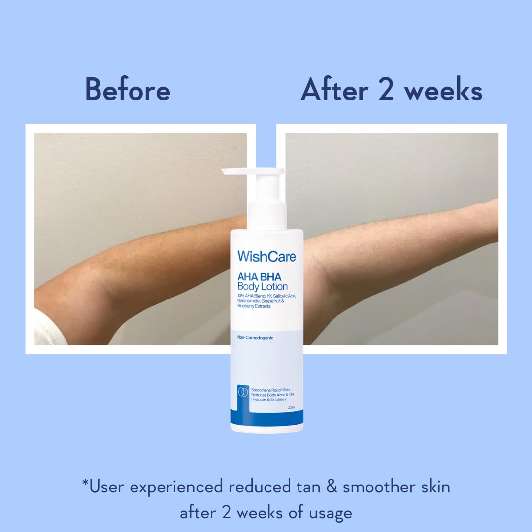 WishCare AHA BHA Body Lotion For Dry Skin | Provides Deep Hydration, Detans & Smooths Rough Skin | With 10% AHA & 1% BHA | Daily Use Body Lotion For Women & Men | 200ml