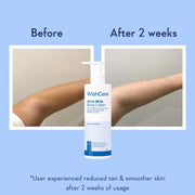 WishCare AHA BHA Body Lotion For Dry Skin | Provides Deep Hydration, Detans & Smooths Rough Skin | With 10% AHA & 1% BHA | Daily Use Body Lotion For Women & Men | 200ml