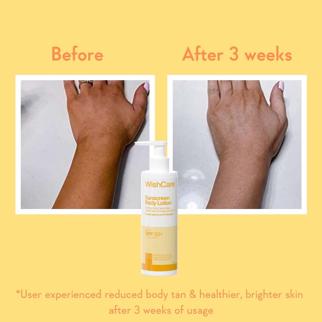WishCare Sunscreen Body Lotion with SPF 50 PA++++ In- Vivo Tested | Body Sunscreen SPF50 With Broad Spectrum UVA & UVB Protection, No White Cast | With Carrot Seed & Raspberry | For All Skin Types | For Women & Men | 200ml