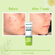 WishCare Salicylic Acid Face Wash For Women & Men | Reduces Acne & Controls Oil | With AHA, Green Tea, Chamomile & Tea Tree | Salicylic Acid Face Wash For Oily Skin & Acne Prone Skin | 100ml