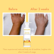 WishCare Sunscreen Body Lotion with SPF 50 PA++++ In- Vivo Tested | Body Sunscreen SPF50 With Broad Spectrum UVA & UVB Protection, No White Cast | With Carrot Seed & Raspberry | For All Skin Types | For Women & Men | 200ml