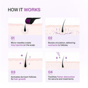 Bare Anatomy Derma Roller for Hair Growth | 0.5 mm with 540 Titanium Micro Needles | Stimulates Hair Follicles & Improves Scalp Circulation