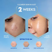 NIVEA Luminous Even Glow Oil Control Face Crème & Moisturiser Serum | Patented Thiamidol (60X More Effective Than Vitamin C) | Salicylic Acid & Hyaluronic Acid | Dark Spots & Pigmentation Serum for Oil Control, Brightening & Hydration | 10ml