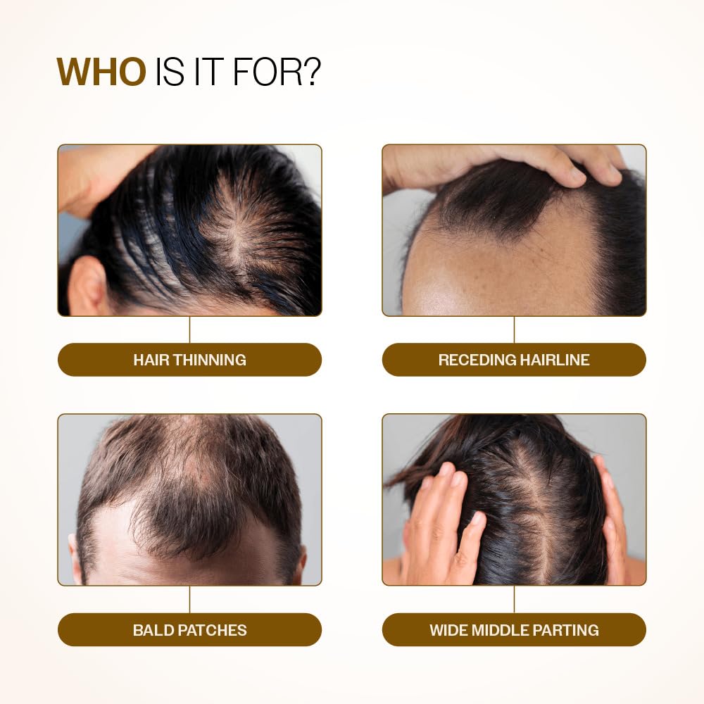 Bare Anatomy Advanced Hair Growth Serum Roll-On| 3% Redensyl + 4% Anagain + 2% Baicapil + 5% Rosemary, Rice Water, Biotin & Saw Palmetto| Reduces Hair Fall, Supports Hair Growth for Men & Women | 25ml-Pack of 2