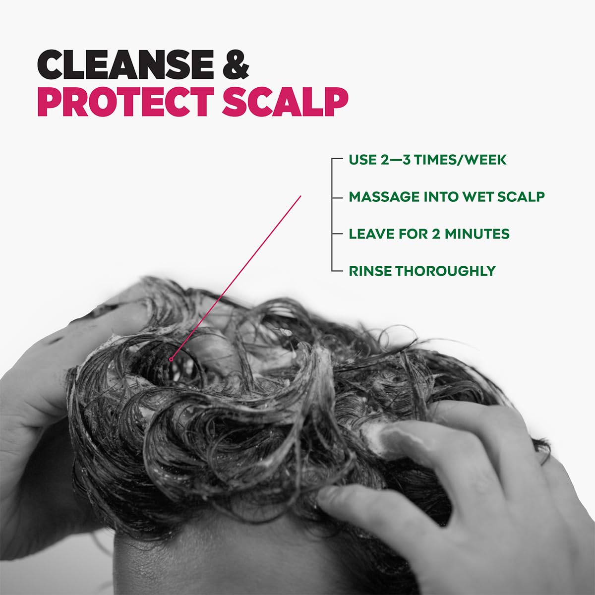 Sebamed Anti Dandruff shampoo | 400 ml