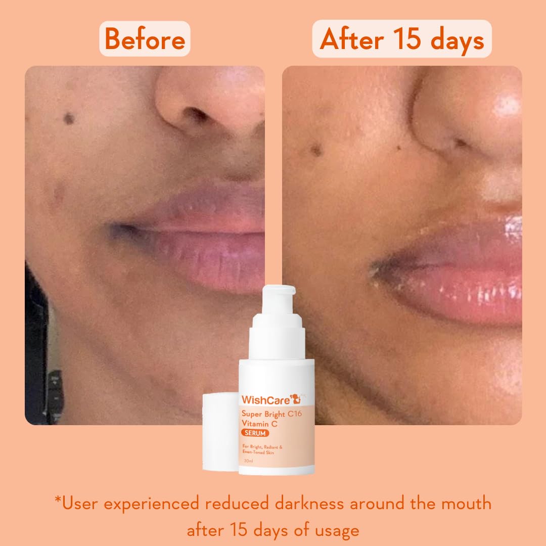 WishCare Super Bright C16 10% Vitamin C Serum For Glowing Skin | With 10% Vitamin C, Niacinamide & Kojic Acid | Face Serum For Women & Men | Reduces Pigmentation & Dark Spots | For Oily Skin, Dry & Combination Skin | 30ml