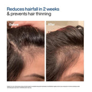 WishCare Advanced Foaming Hair Growth Serum- Redensyl, Anagain, Baicapil, Caffeine, Biotin & Rice PDRN - Advanced Serum Foam for Hair Fall Control & Hair Growth 50g