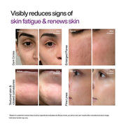 WishCare Cellular Reset 0.1% Retinal Shot- Targets Fine Lines, Wrinkles & Dark Circles | Retinol Shot Booster- 10 ml