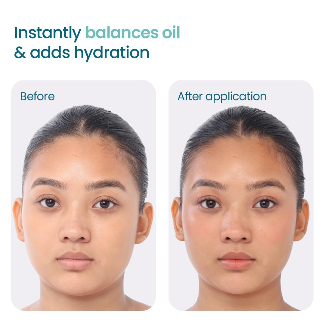 WishCare 2:1:3 NMF Water Gel Moisturizer for Face Oily Skin, Dry Skin, 50ml