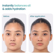 WishCare 2:1:3 NMF Water Gel Moisturizer for Face Oily Skin, Dry Skin, 50ml
