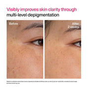 WishCare Advanced Dark Spot Correcting Serum - TXA Shot | 10% Niacinamide Face Serum For Pigmentation and Dark Spot | With 2% Alpha Arbutin & TXA for Glowing Skin | 10ml
