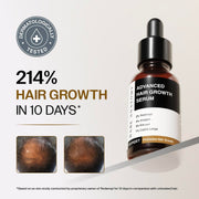 Bare Anatomy Expert Anti-Hair Fall Shampoo (100ml) & Advanced Hair Growth Serum (30ml) | Adenosine + Redensyl + Rice Water + Rosemary| Hair Growth & Hair Fall Control Combo for Women & Men