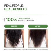 Bare Anatomy Anti-Dandruff Shampoo & Conditioner Combo | Up to 100% Dandruff Control Reduces Dryness & Frizz | For All Hair Types | 250ml + 175gm
