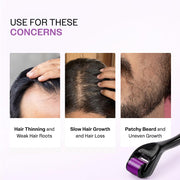 Bare Anatomy Derma Roller for Hair Growth | 0.5 mm with 540 Titanium Micro Needles | Stimulates Hair Follicles & Improves Scalp Circulation