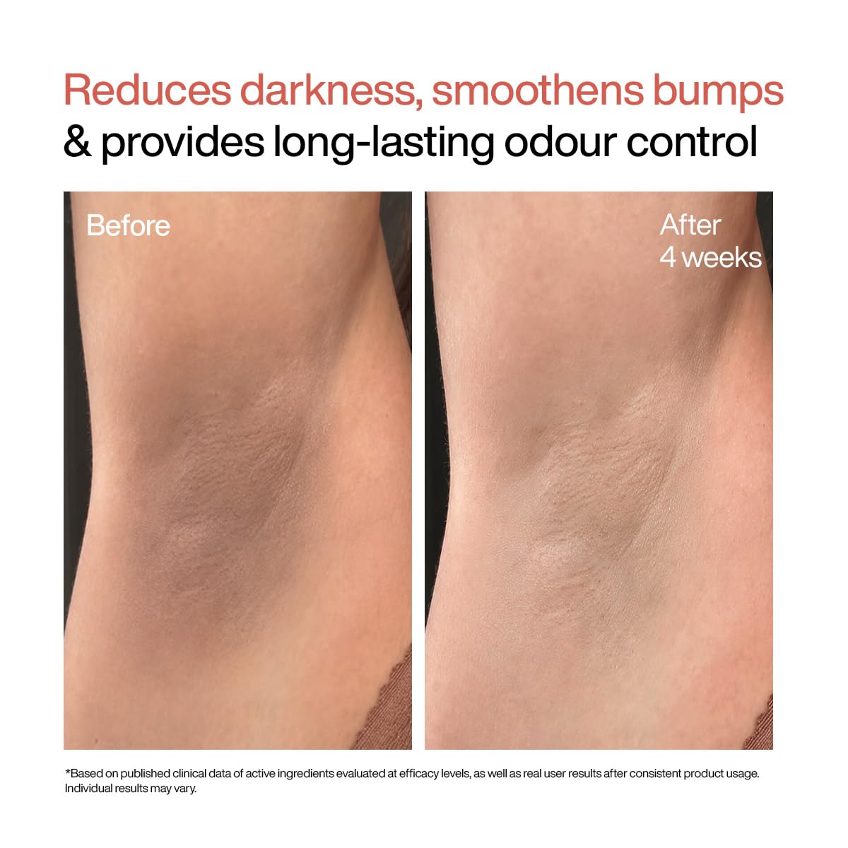 WishCare Underarm Roll On Serum - 5% AHA, 3% Kojic Acid, BHA, Licorice, Inulin - Underarm Lightening & Odour Control - Long Lasting Vanilla Fragrance