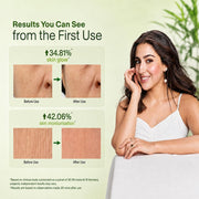Biotique Morning Nectar Flawless Skin Moisturizer Lotion L Prevents Dark Spots, Blackheads And Blemishes L Visibly Flawless Skin L Nourishes And Hydrates Skin L All Skin Types L 190Ml