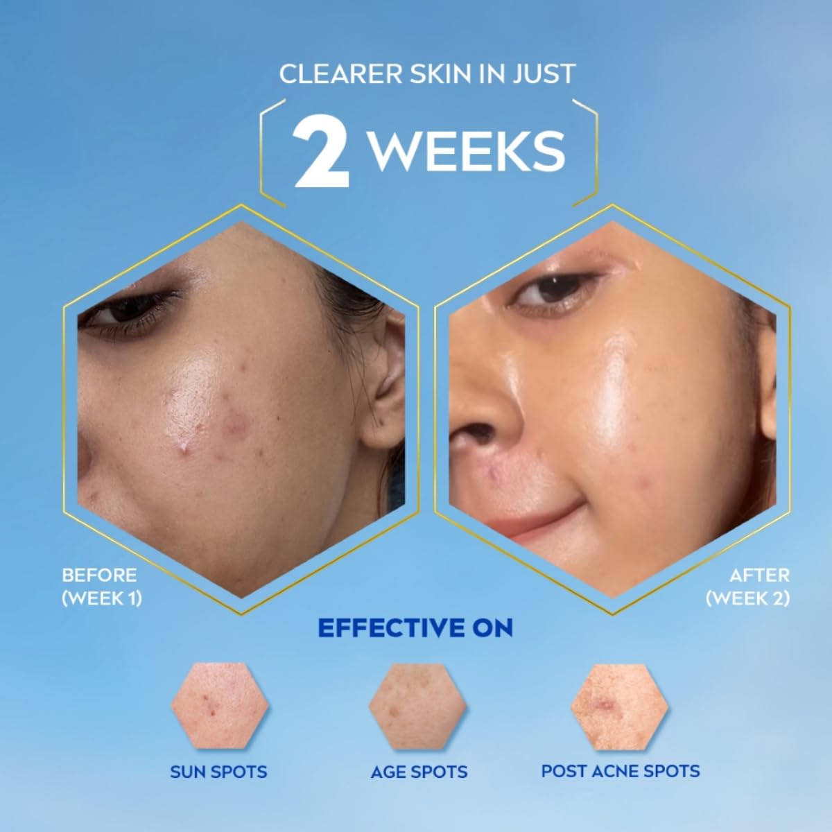 NIVEA Luminous Even Glow Anti-Spot Day Cream 40ml