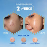 NIVEA Luminous Even Glow Anti-Spot Day Cream 40ml