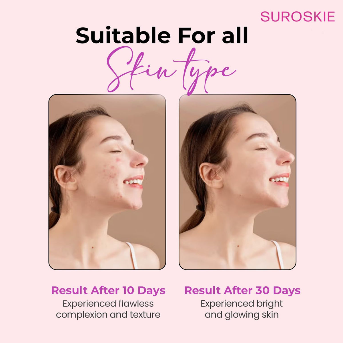 Suroskie Rose Instant Enzyme Face Scrub & Rosanna Glow Face Mask Combo (Pack Of 2*50Ml) | For Fine Lines & Clear Dark Spots | Glowing & Brighten Skin | Removes White Heads & Black Heads |Men & Women