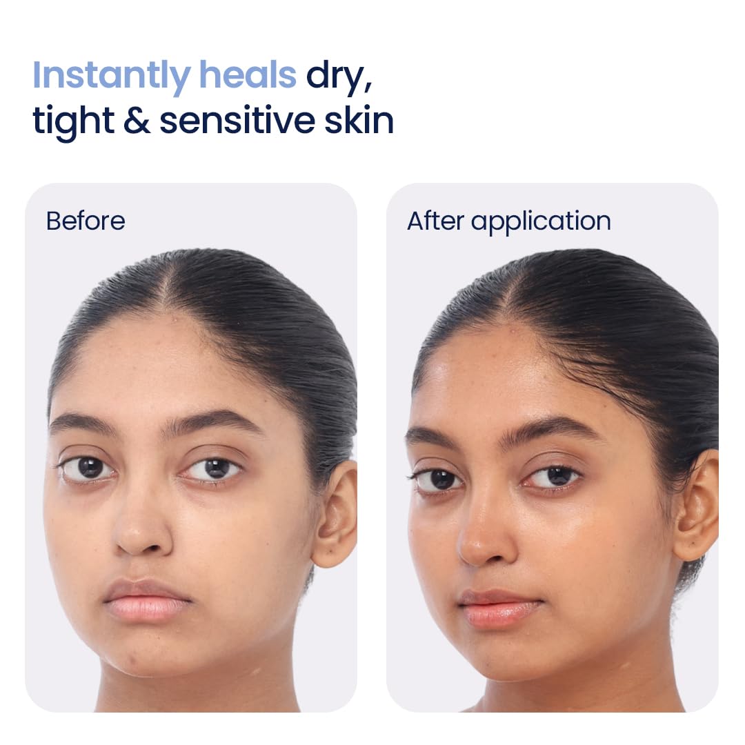 WishCare 3:1:1 Barrier Repair Moisturizer Cream for Face | Barrier Repair Moisturizer With Ceramides, EGF & Mung Mucin | Repairs Skin Barrier, Calms & Soothes | For Dry Skin, Oily & Combination Skin | For Men and Women | 50ml