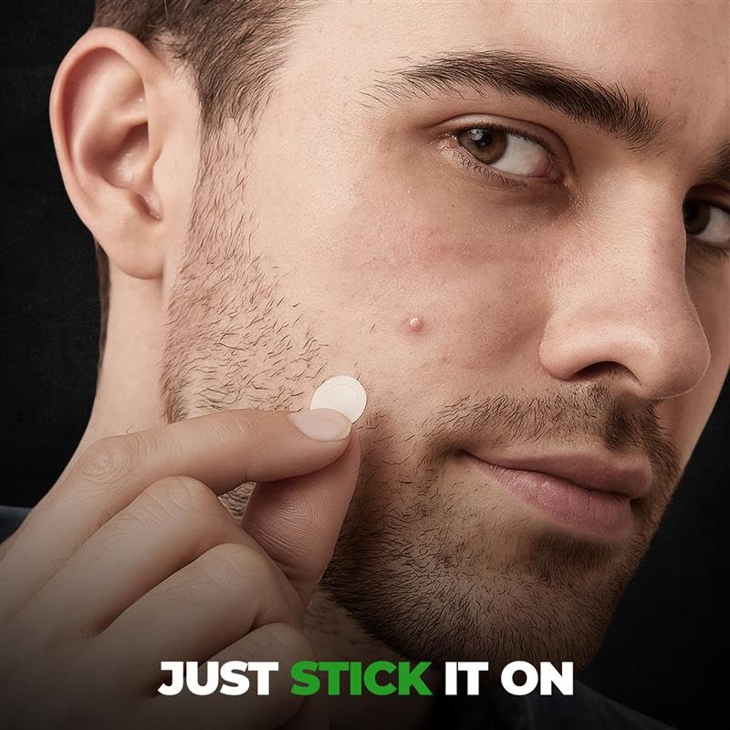 Beardo Acne Pimple Patch for Face with Salicylic Acid (72 dots) | Waterproof Patches for Active Acne | Absorbs Pimple Overnight and Reduces Excess Oil | Pimple Patches for Men