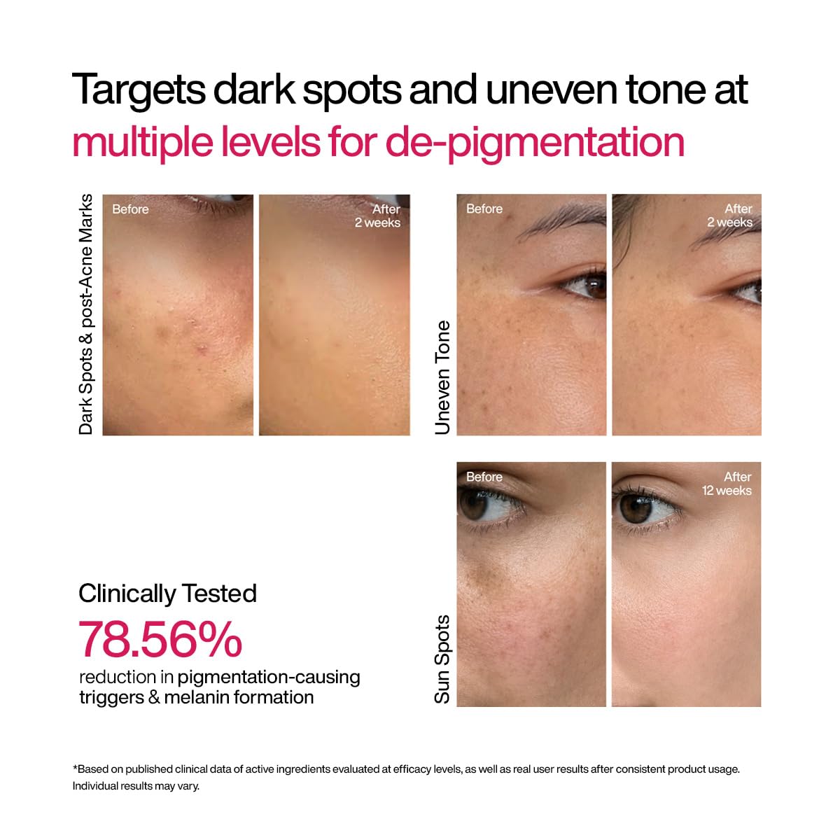 WishCare Advanced Dark Spot Correcting Serum - TXA Shot | 10% Niacinamide Face Serum For Pigmentation and Dark Spot | With 2% Alpha Arbutin & TXA for Glowing Skin | 10ml
