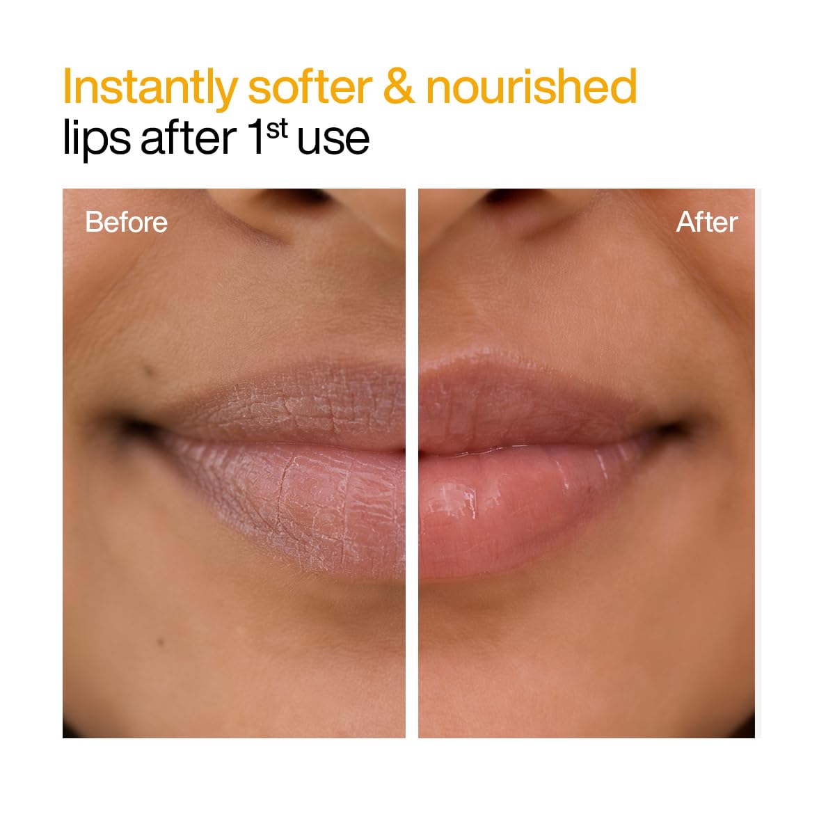 WishCare Ceramide Lip Balm SPF 50 PA++++ | Brightening Lip Balm for Dark Lips | In-Vivo Tested | Kojic Acid & Niacinamide | Natural & Untinted | For Women & Men | 5g