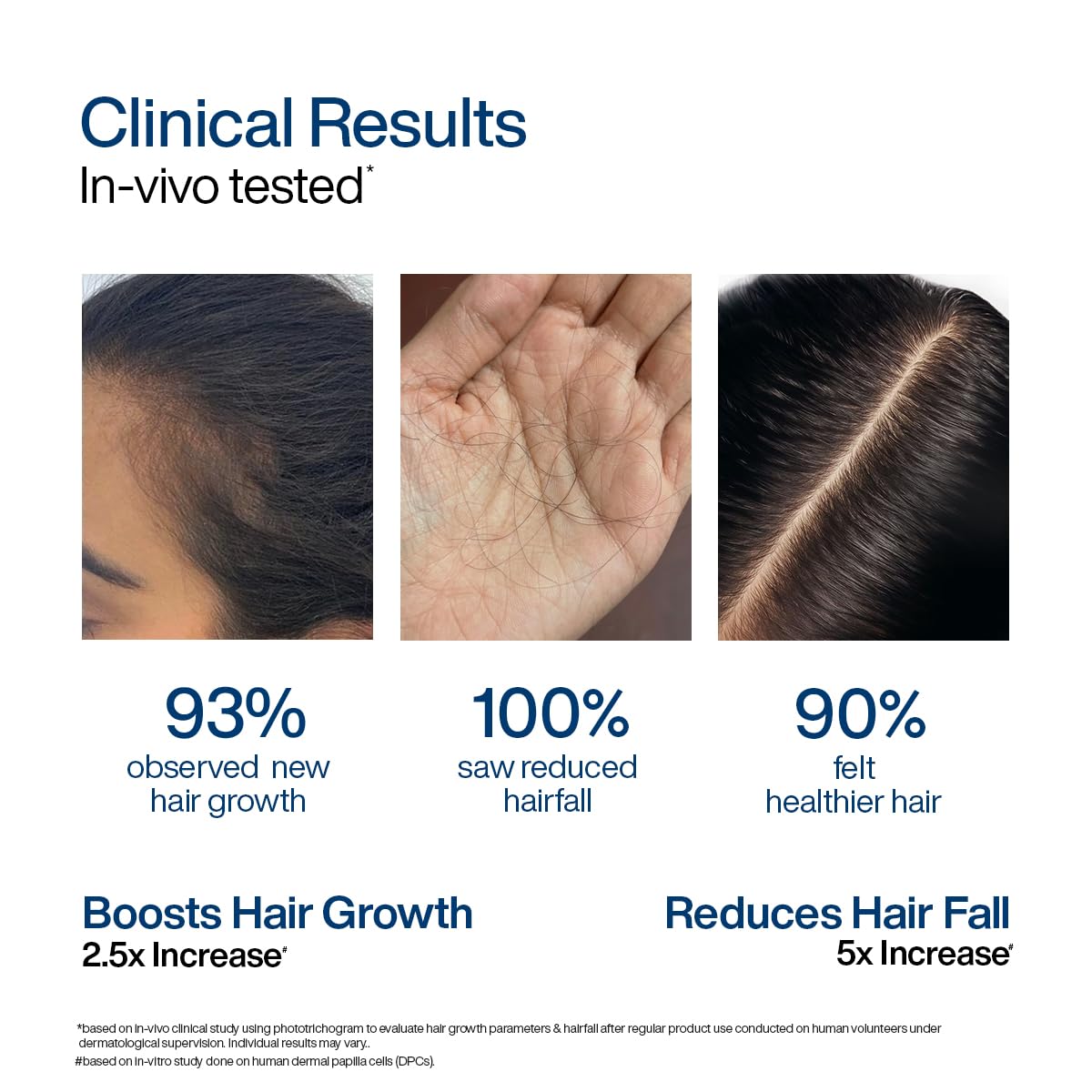 WishCare Hair Growth Serum Roll On For Scalp | 94% Saw New Hair Growth | Redensyl & Rosemary Oil | 100% Saw Hairfall Reduction | In-Vivo Tested | For Men & Women | 10ml