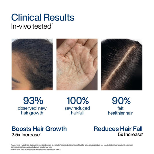 WishCare Hair Growth Serum Roll On For Scalp | 94% Saw New Hair Growth | Redensyl & Rosemary Oil | 100% Saw Hairfall Reduction | In-Vivo Tested | For Men & Women | 10ml