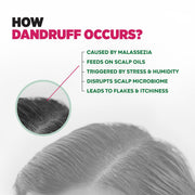 Sebamed Anti Dandruff shampoo | 400 ml