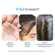 Be Bodywise 3% Redensyl & Rosemary Hair Growth Serum (Roll On) | Pack of 2 |with 2% Anagain | Thicker & Stronger Hair | Prevents Hairfall & Stimulates Hair Follicles | For All Hair Types | 50ml each