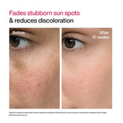 WishCare Advanced Dark Spot Correcting Serum - TXA Shot | 10% Niacinamide Face Serum For Pigmentation and Dark Spot | With 2% Alpha Arbutin & TXA for Glowing Skin | 10ml