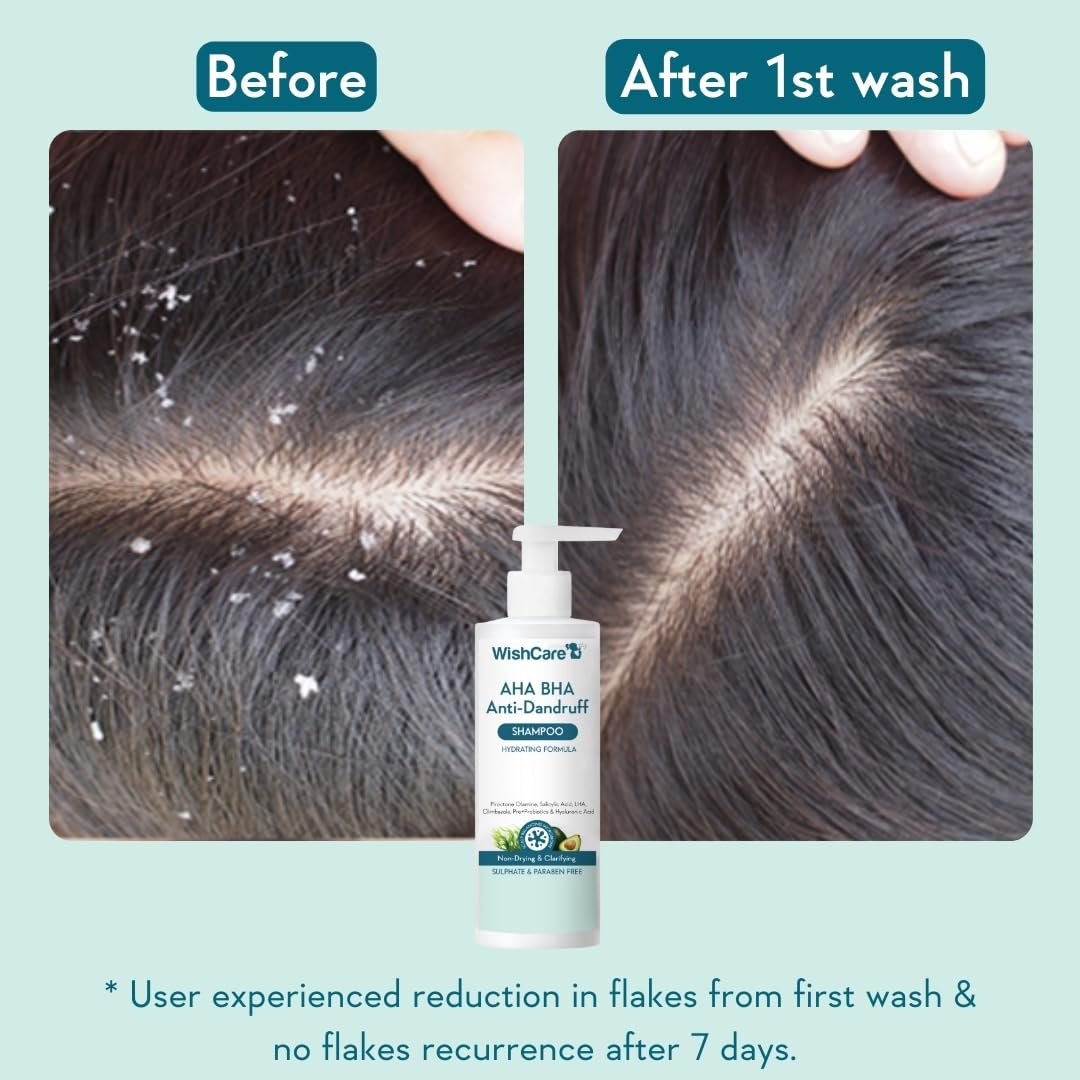 WishCare Hydrating Anti Dandruff Shampoo | 100% Dandruff Reduction | Removes Flakes & Hydrates Scalp | Proven Clinically | Piroctone Olamine, Salicylic Acid, AHA & BHA | Paraben & Sulphate Free | For Women And Men | 250ml