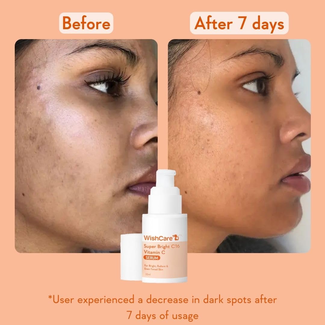 WishCare Super Bright C16 10% Vitamin C Serum For Glowing Skin | With 10% Vitamin C, Niacinamide & Kojic Acid | Face Serum For Women & Men | Reduces Pigmentation & Dark Spots | For Oily Skin, Dry & Combination Skin | 30ml