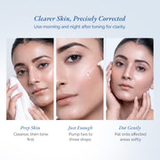 Biotique Professional Clarifying + Oil & Pimple Control Stem Cell Corrective Acne & Dark Spot Treatment Serum 30ml