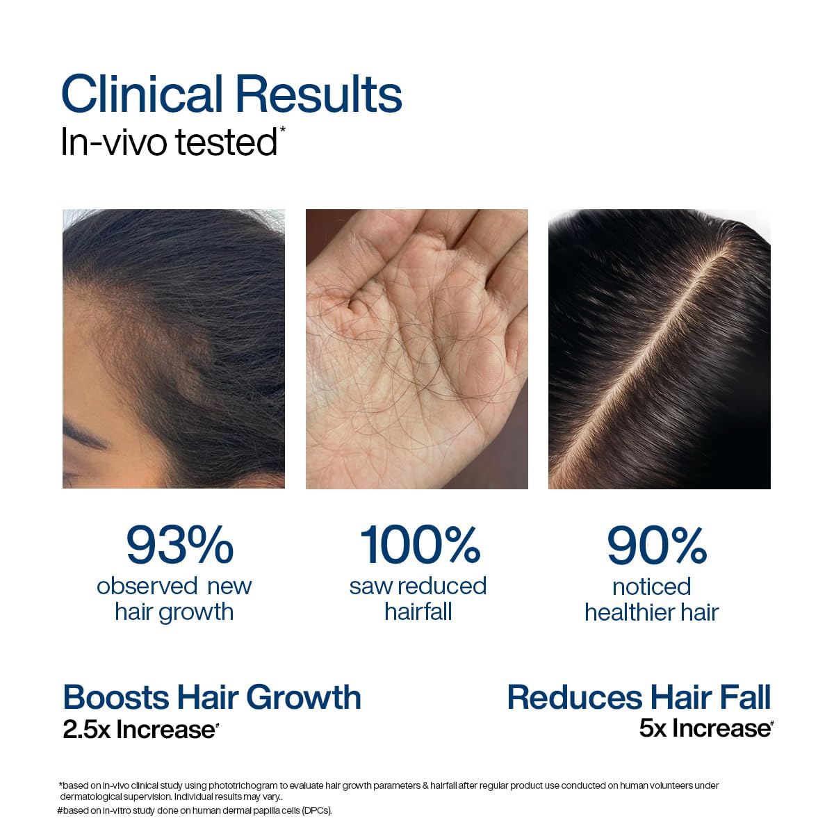 WishCare Advanced Foaming Hair Growth Serum- Redensyl, Anagain, Baicapil, Caffeine, Biotin & Rice PDRN - Advanced Serum Foam for Hair Fall Control & Hair Growth 50g