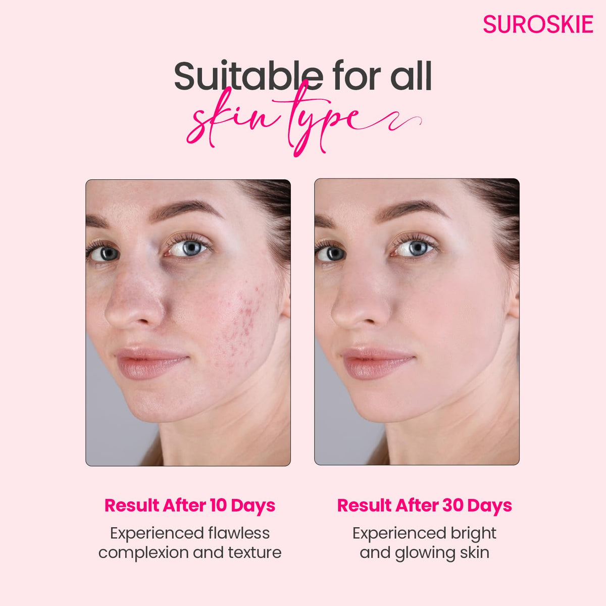 Suroskie Glass Glow Duo Combo (Pack of 2) | Rosanna Rose Instant Glow Face Mask (50ml) & Rose Glass Skin Mist (100ml) | for Glowing & Brighten Skin | Cleans Pores & Dark Spot | for Men & Women