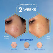 NIVEA Luminous Even Glow Night Cream & Moisturiser | Patented Thiamidol (60X More Effective Than Vitamin C) | Dark Spots & Pigmentation | Hyaluronic Acid Brightening Night Cream for Even Skin Tone & Deep Hydration | 40ml