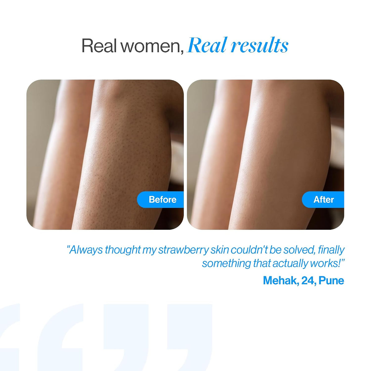 Be Bodywise 5% AHA BHA Exfoliating Detan Body Wash (Flora Fragrance) 700ml | For Body Acne, Strawberry Skin, De-Tan | 3% Lactic Acid, 1% Salicylic Acid, 1% Glycolic Acid | Non-Drying, Paraben Free