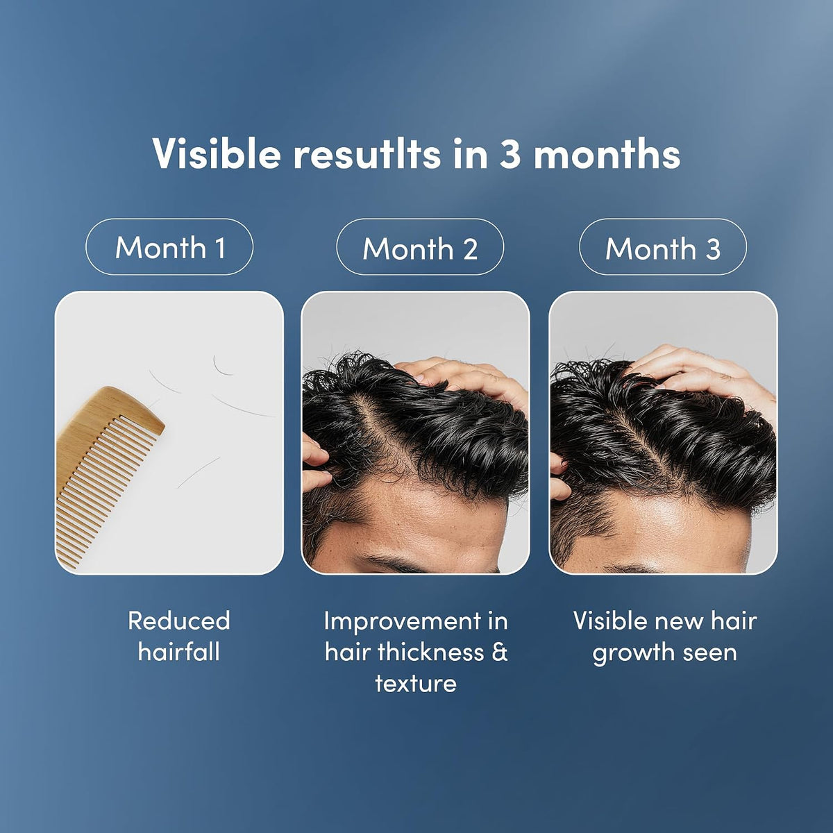 Man Matters Advanced Hair Serum 30ml | 23% actives (3% Redensyl, 2% Anagain & 1% Aminexil, Rosemary Leaf Extract) | Reactivates Hair Cells, Improves Density & Promotes Growth | Paraben Free