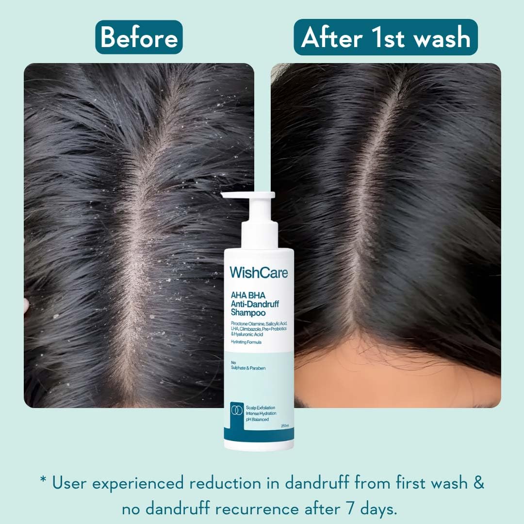 WishCare Hydrating Anti Dandruff Shampoo | 100% Dandruff Reduction | Removes Flakes & Hydrates Scalp | Proven Clinically | Piroctone Olamine, Salicylic Acid, AHA & BHA | Paraben & Sulphate Free | For Women And Men | 250ml