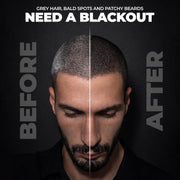 Beardo Blackout Hair Powder 4g - Black | Root Touch Up for Grey Hair | Instantly Covers Grey Roots, Beard Patches & Bald Spots | Thick Black Fiber Hairline Powder | Highly Pigmented, Long-Lasting & Matte Finish | Super-Fine Cover-up
