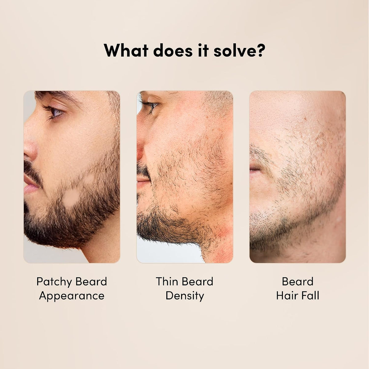 Man Matters BeardGro Beard Growth Serum for Men 30ml | 4% Anagain, 1% Rosemary, 2% Aminexil | Promotes Thicker Beard Growth, Reduces Patchy Beard , Fast Absorption and Lightweight | Pack of 2