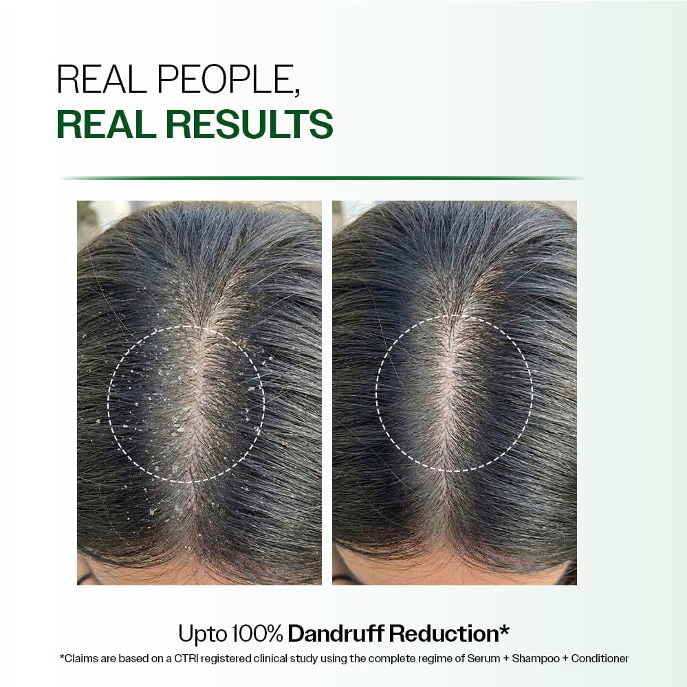 Bare Anatomy Advanced Anti-Dandruff Serum | Helps Reduce Dandruff | Defenscalp™ + Salicylic Acid + Pentavitin | Lightweight, Non-Sticky Scalp Serum | For Men & Women | 50 ml