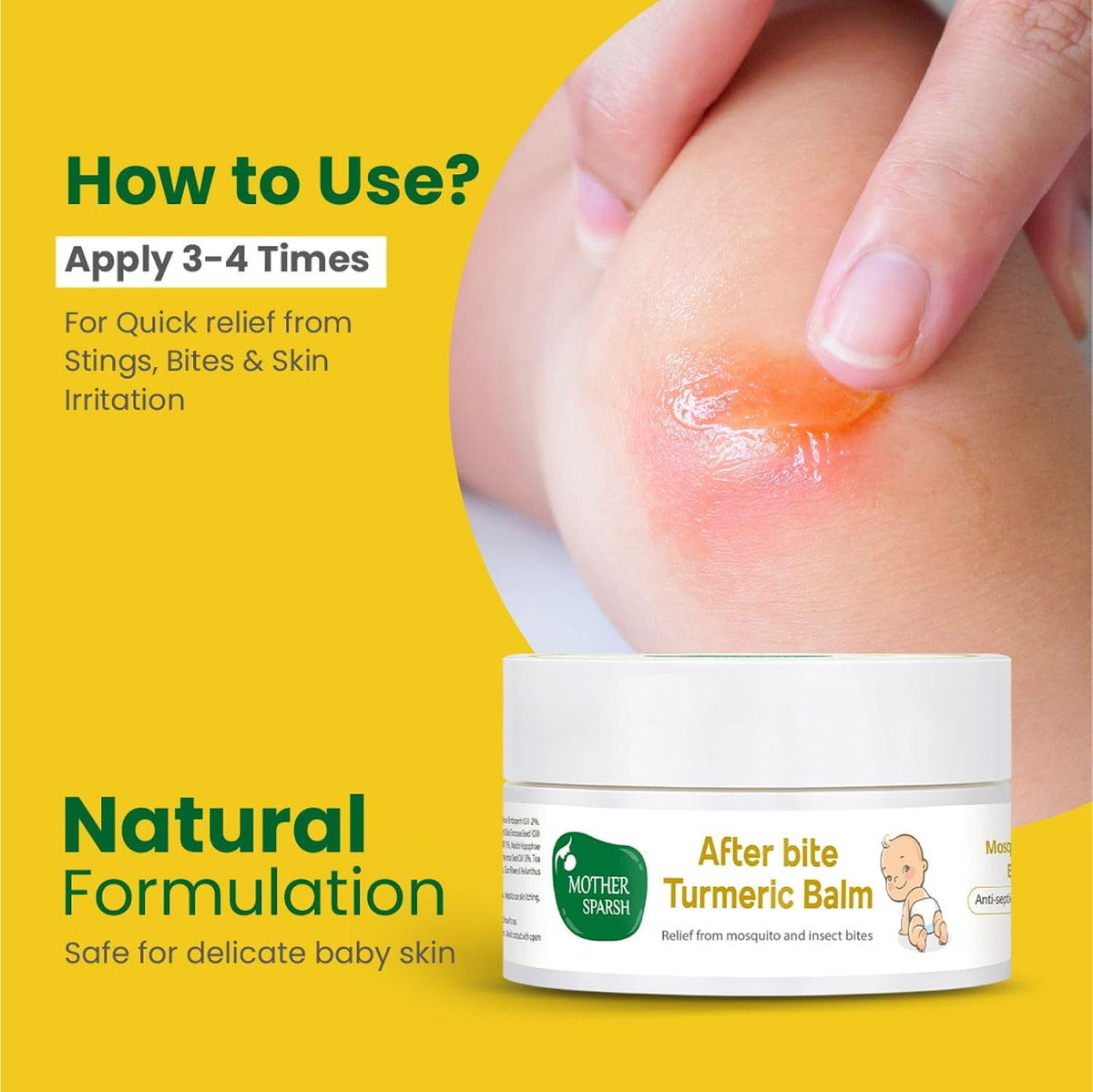Mother Sparsh After Bite Turmeric Balm for Rashes And Mosquito Bites, 100% Ayurvedic, Gentle Skin Roll-On Formula, 25gm