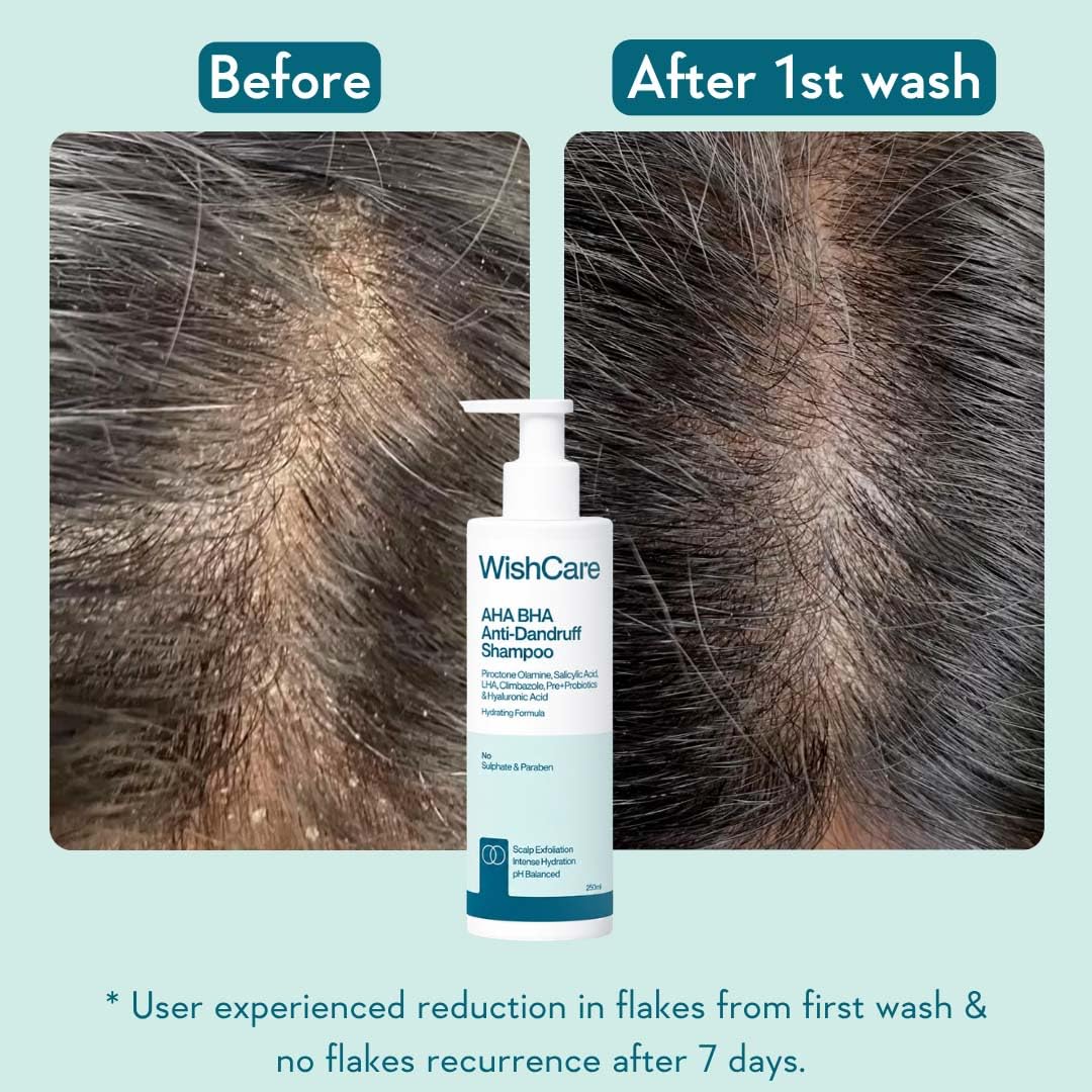 WishCare Hydrating Anti Dandruff Shampoo | 100% Dandruff Reduction | Removes Flakes & Hydrates Scalp | Proven Clinically | Piroctone Olamine, Salicylic Acid, AHA & BHA | Paraben & Sulphate Free | For Women And Men | 250ml