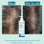 WishCare Hydrating Anti Dandruff Shampoo | 100% Dandruff Reduction | Removes Flakes & Hydrates Scalp | Proven Clinically | Piroctone Olamine, Salicylic Acid, AHA & BHA | Paraben & Sulphate Free | For Women And Men | 250ml